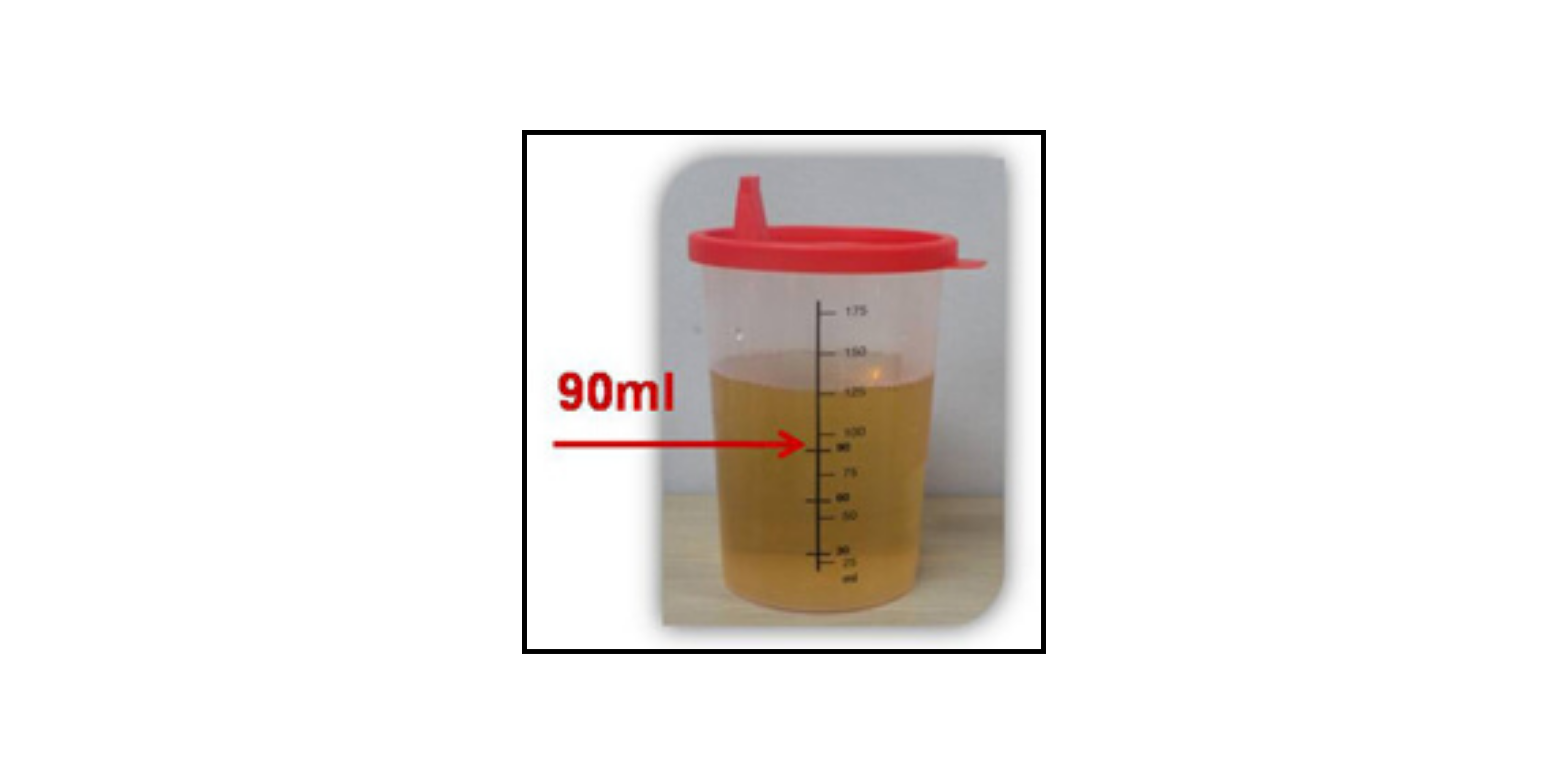 Clear plastic medical cup with red lid containing yellow liquid filled to the 90ml mark, indicated by a red arrow.