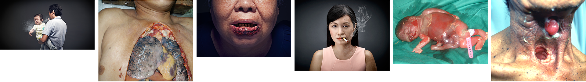 Series of body parts affected by tobacco.