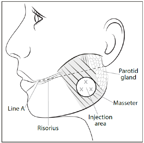 Botox Dosage Image 4