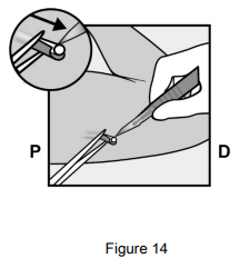 Implanon Dosage Figure 14