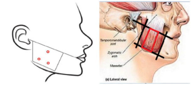 Nabota Dosage Image 3