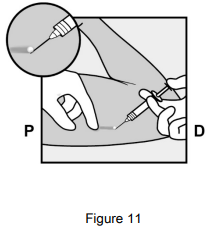 Implanon Dosage Figure 11